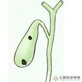 陶瓷樣膽囊