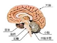 單發腦梗死性癡呆 單發腦梗死性癡呆
