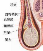 鞘膜積液 鞘膜積液