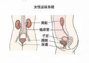 女性膀胱頸梗阻 女性膀胱頸梗阻