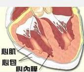心內膜彈性纖維增生癥 心內膜彈性纖維增生癥